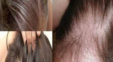 فوائد الروزماري والقرنفل في أنبات الشعر – البوكس نيوز