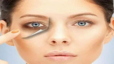 طريقة علاج الهالات السوداء تحت العين بمكونات طبيعية – البوكس نيوز