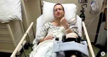تكنولوجيا  – مارك زوكربيرج يخضع لعملية جراحية بسبب إصابة فى الركبة
