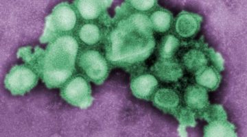 بريطانيا ترصد أول حالة بشرية مصابة بسلالة إنفلونزا مشابهة لفيروس يصيب الخنازير | صحة – البوكس نيوز