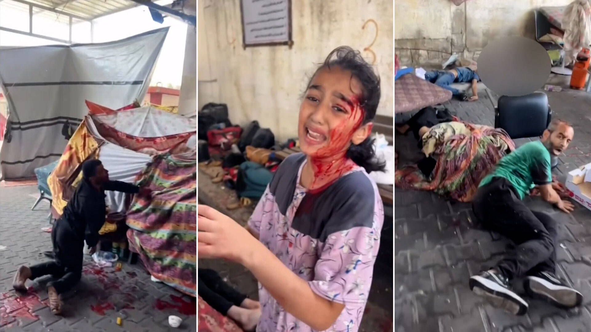 شهداء وجرحى بقصف الاحتلال لمستشفيات غزة والدبابات تحاصر مستشفى الرنتيسي للأطفال | أخبار – البوكس نيوز