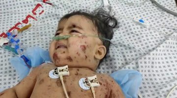 شهادات مؤلمة من مستشفى كمال عدوان في غزة عقب تعرضه للقصف | أخبار – البوكس نيوز