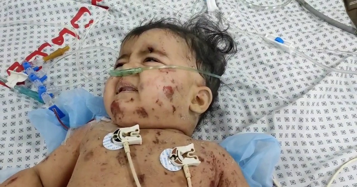 شهادات مؤلمة من مستشفى كمال عدوان في غزة عقب تعرضه للقصف | أخبار – البوكس نيوز