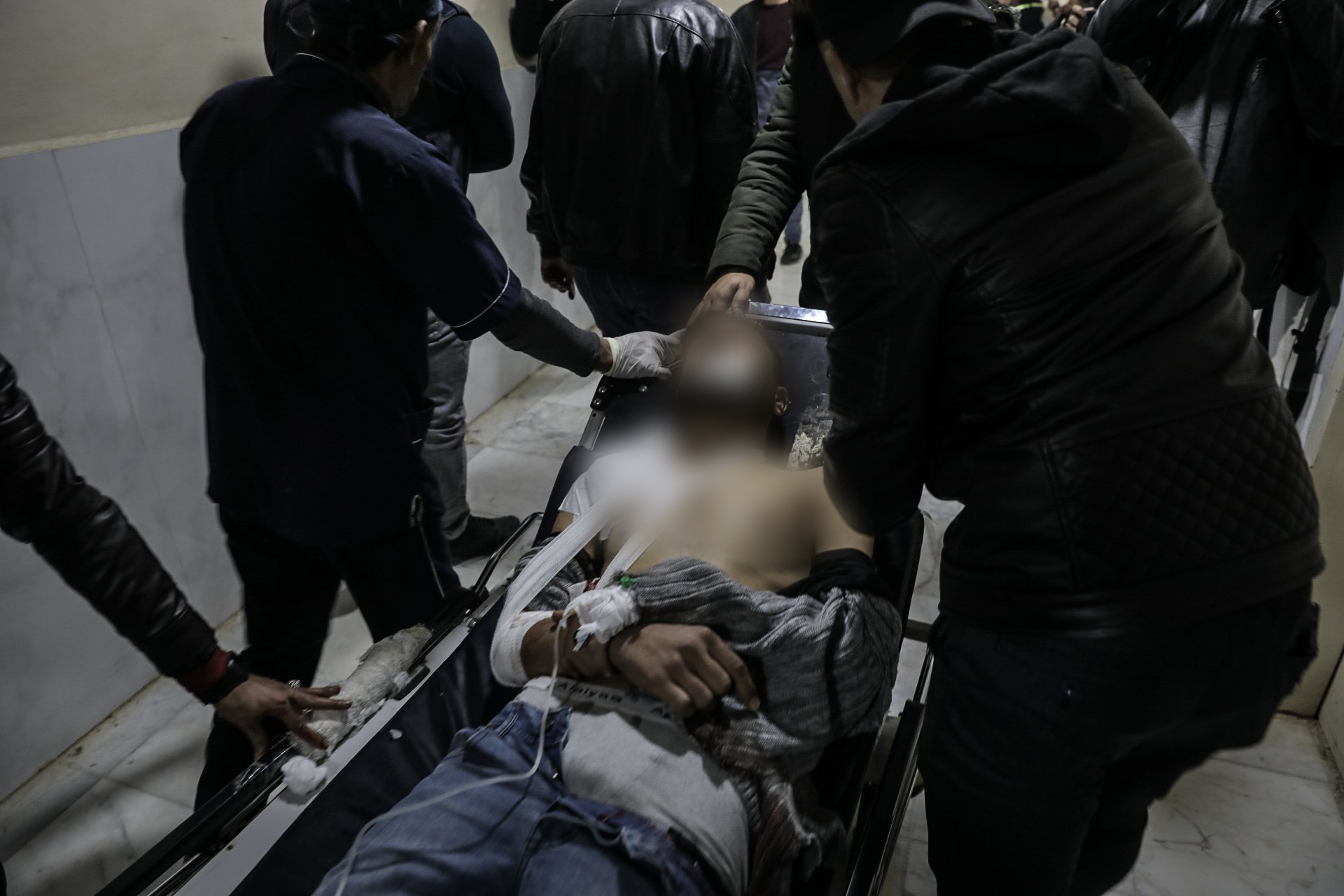 مقتل مدنييْن وإصابة العشرات بقصف للنظام السوري على إدلب | أخبار – البوكس نيوز