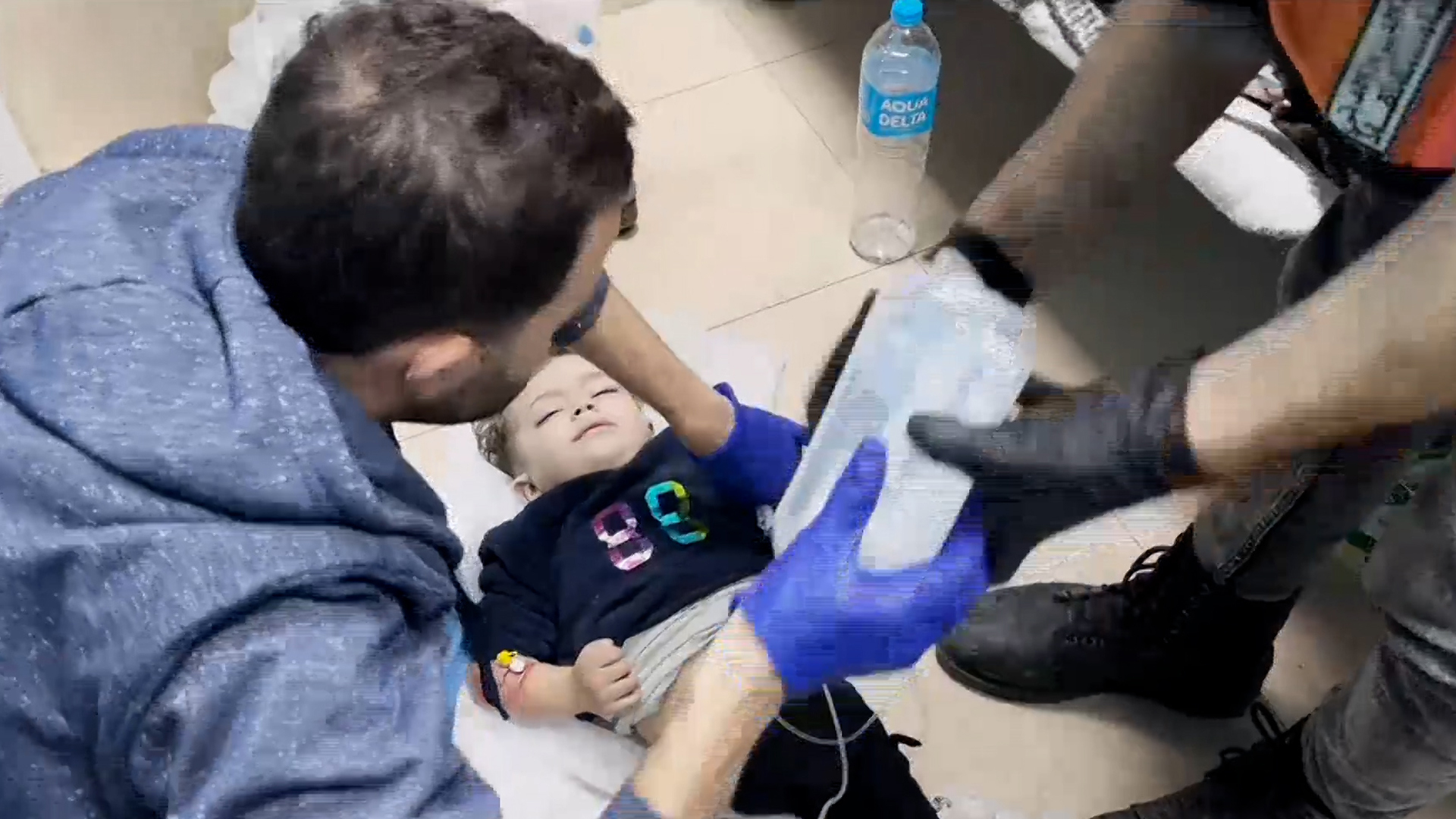 شاهد.. طفل يبكي من شدة الألم الذي أصابه جراء قصف إسرائيلي على دير البلح | أخبار – البوكس نيوز