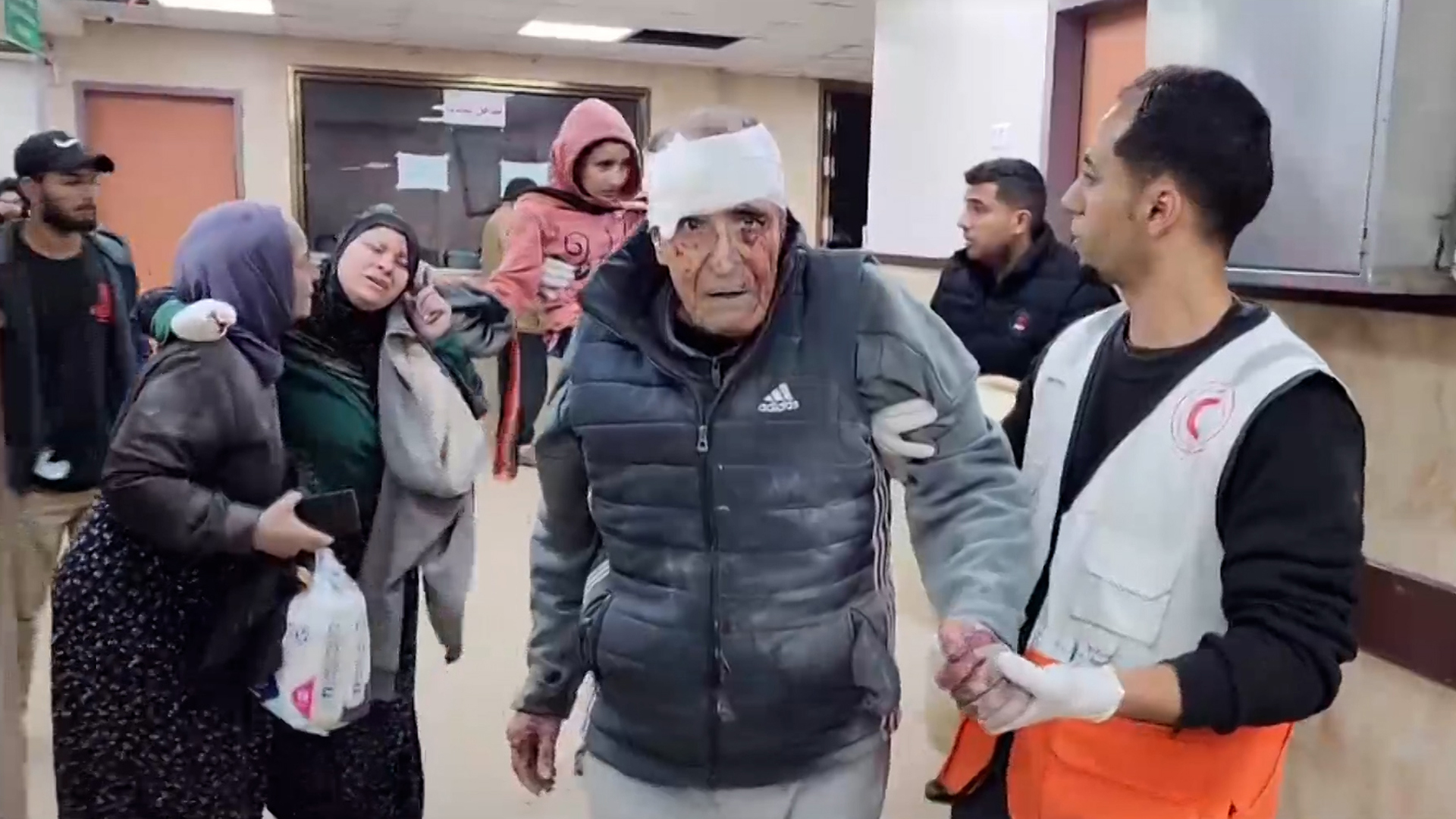 مشاهد شهداء وجرحى بمستشفى شهداء الأقصى بعد قصف منازل مواطنين | البرامج – البوكس نيوز