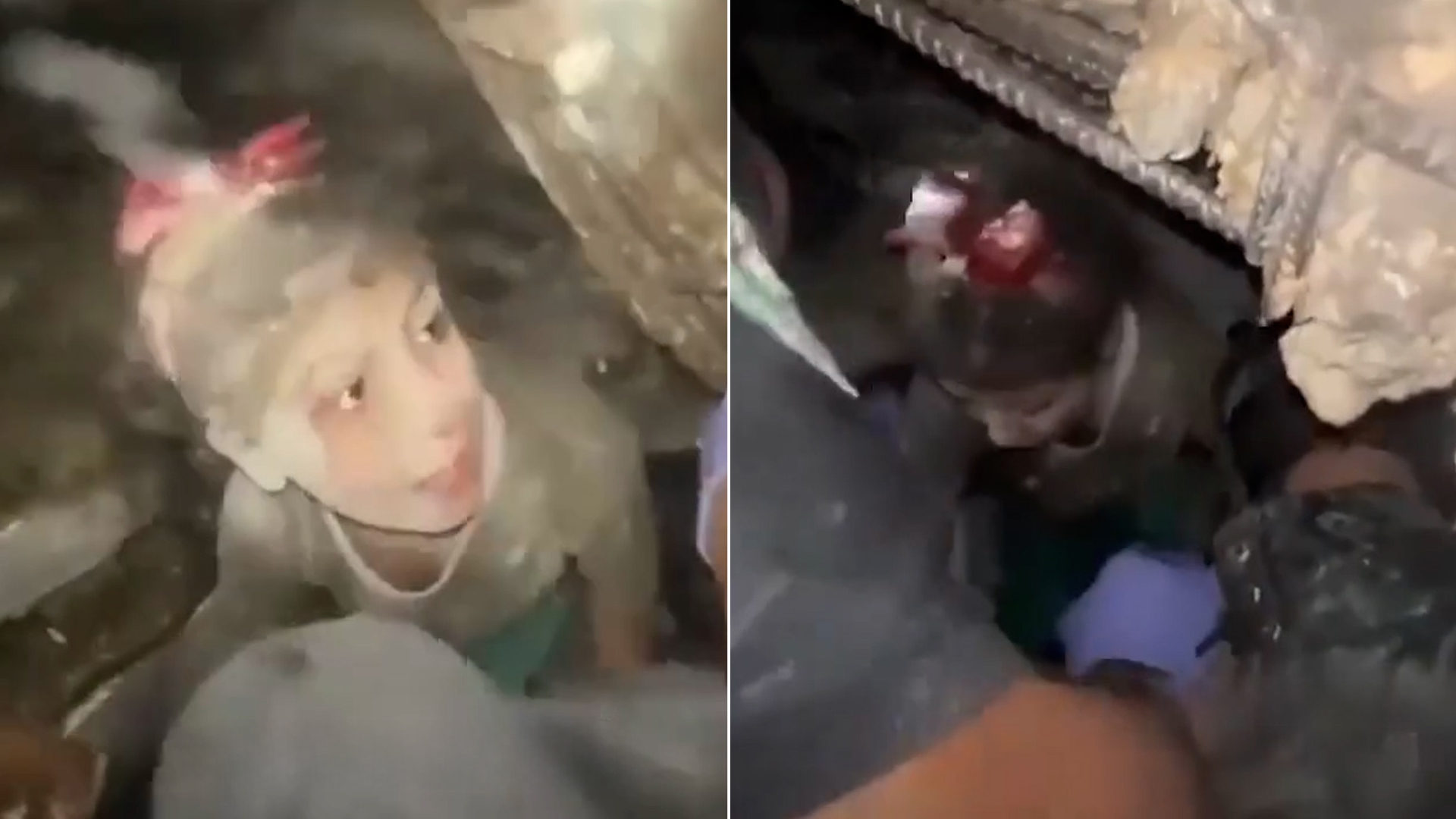 لماذا رفضت الطفلة “ألما” انتشالها من تحت ركام منزلها بغزة وأثارت تعاطفا واسعا؟ | أخبار – البوكس نيوز