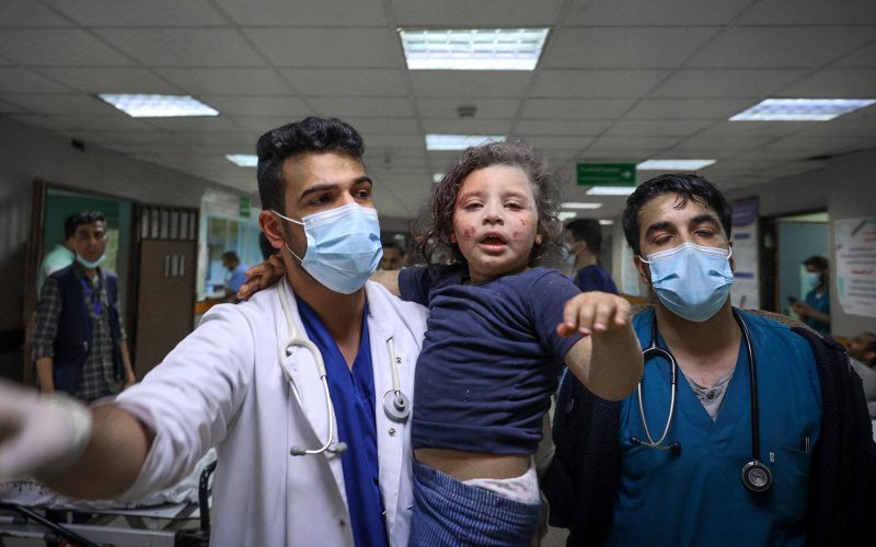 طبيب أميركي بغزة: أغلب الإصابات لأطفال وإغلاق المعابر يفاقمها | أخبار – البوكس نيوز