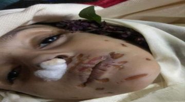 وفاة طفلة تحت التعذيب في مناطق الحوثيين
