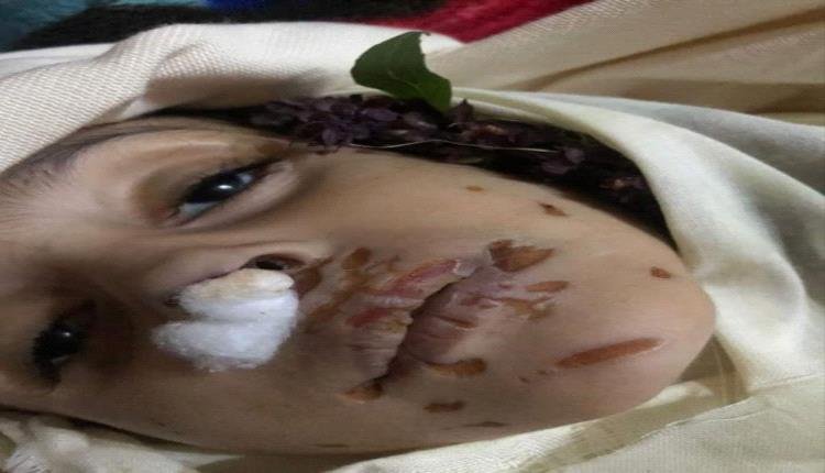 وفاة طفلة تحت التعذيب في مناطق الحوثيين
