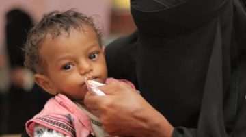 الأغذية العالمي يتلقى تمويلاً سعودياً لمواجهة سوء التغذية في اليمن