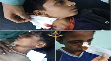 الواقعة الثانية بأسبوع.. انفجار مقذوف حوثي في 3 أطفال شمال الضالع