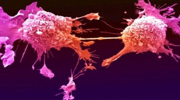 باحثون: رسائل في زجاجة تقلص الأورام