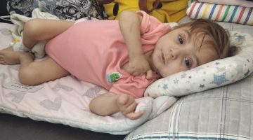 أطفال غزة ضحايا سياسة التجويع الإسرائيلية | سياسة – البوكس نيوز