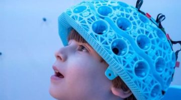 ماسح ضوئي يكشف أسرار تطور دماغ الأطفال