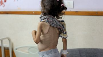 مجاعة غزة.. أمهات يبحثن عن حليب لإطفالهن | أخبار – البوكس نيوز